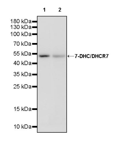 7-DHC/DHCR7 Recombinant Rabbit mAb (S-3625-32)