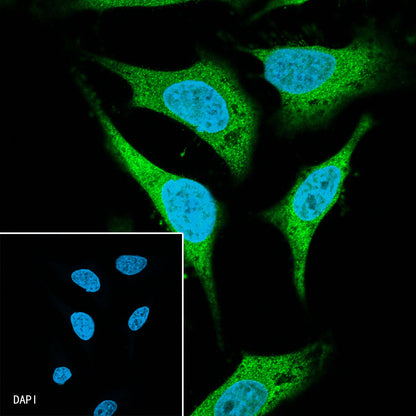 Hsp90 beta Recombinant Rabbit mAb (SDT-359-59)