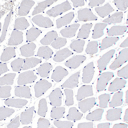 TRF Recombinant Rabbit mAb (S-613-85)