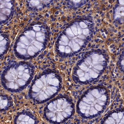Lumican Recombinant Rabbit mAb (S-247-47)