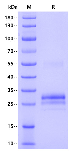 Human TL1A/TNFSF15 Protein, His Tag