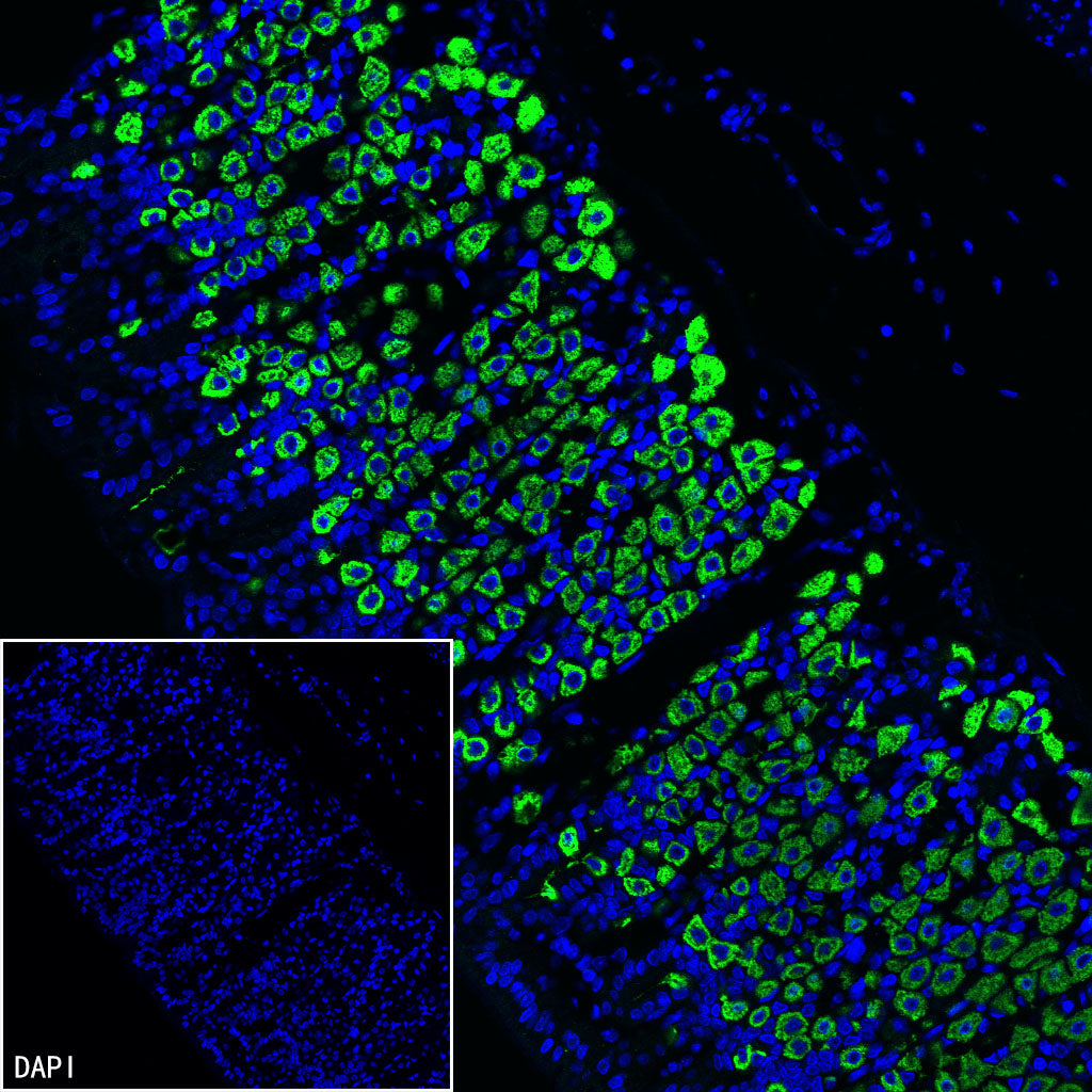 H+/K+-ATPase Recombinant Rabbit mAb (S-3474-110)