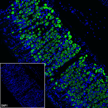 H+/K+-ATPase Recombinant Rabbit mAb (S-3474-110)