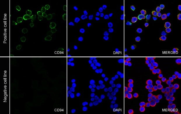 CD94 Recombinant Rabbit mAb (S-2616-17)