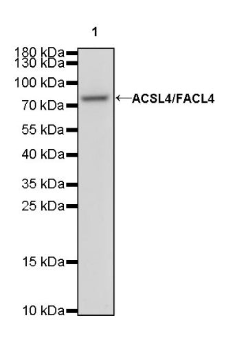 ACSL4/FACL4 Recombinant Rabbit mAb (S-461-6)