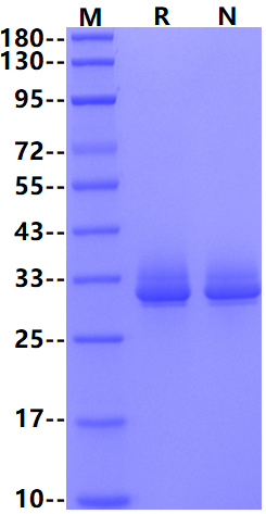 Biotinylated Angiopoietin-like 3/ANGPTL3 His&Avi Tag Protein, Human
