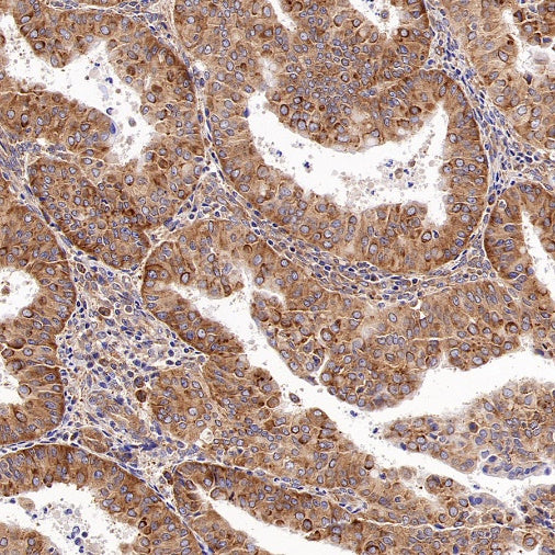 G3BP1 Rabbit Polyclonal Antibody