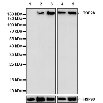 TOP2A Recombinant Rabbit mAb (S-513-107)
