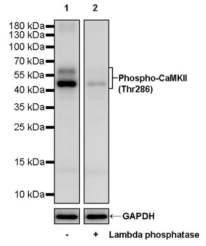 Phospho-CaMKII (Thr286) Recombinant Rabbit mAb (S-1251-278)