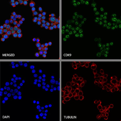 CDK9 Recombinant Rabbit mAb (S-2661-10)