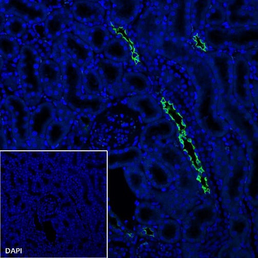 AQP2 Recombinant Rabbit mAb (SDT-2149-19)