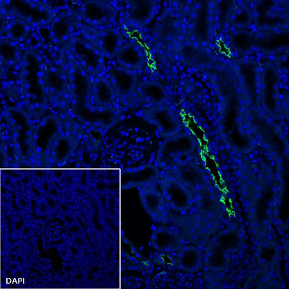 AQP2 Recombinant Rabbit mAb (SDT-2149-19)