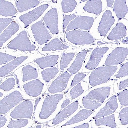 CMTM6 Recombinant Rabbit mAb (S-2013-4)