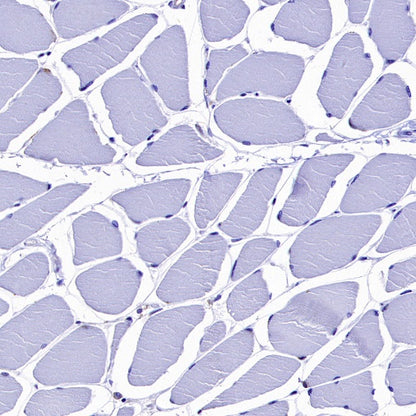 CMTM6 Recombinant Rabbit mAb (S-2013-4)
