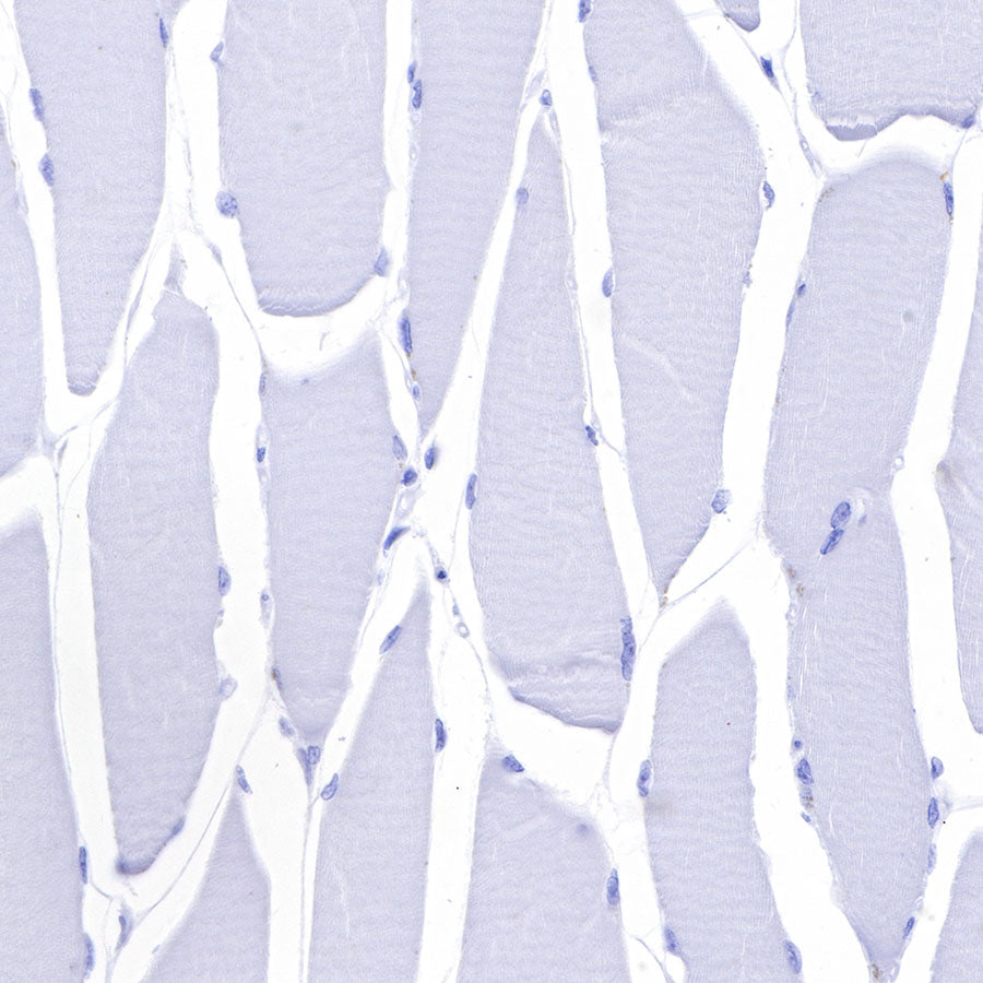 GFAP Recombinant Rabbit mAb (SDT-306-10)