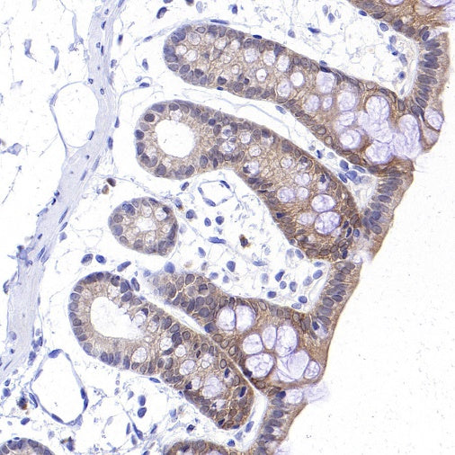 S-RMab® Caspase-7 Recombinant Rabbit mAb (S-1539-42)