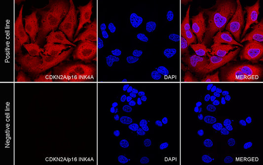 CDKN2A/p16 INK4A Recombinant Mouse mAb (Alexa Fluor® 594 Conjugate) (SDT-4675)