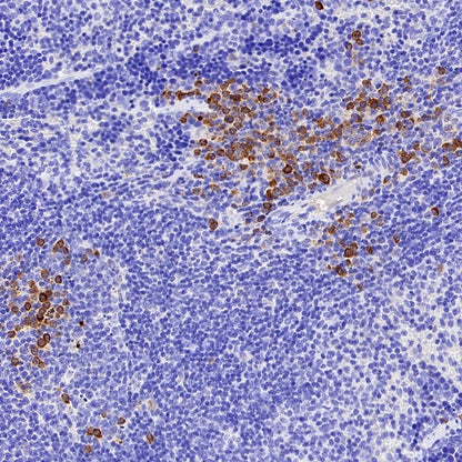 CD11c Recombinant Rabbit mAb (S-3824)