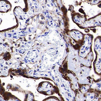 PTGES Recombinant Rabbit mAb (S-4351-18)