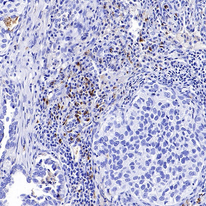 Human IgA1 Rabbit Polyclonal Antibody
