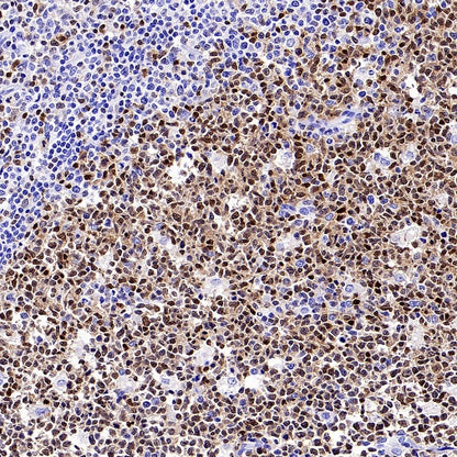 TOX Recombinant Rabbit mAb (S-2296-44)