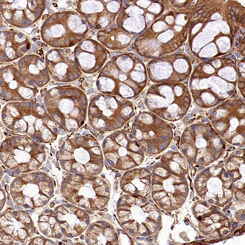 PFKL+PFKM Recombinant Rabbit mAb (S-1302-31)