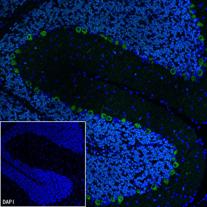 NeuroD1 Recombinant Rabbit mAb (SDT-3843-59)