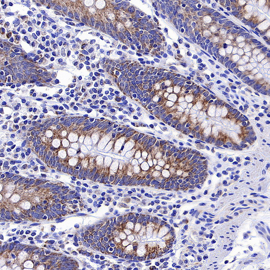 CHCHD2 Recombinant Rabbit mAb (S-4107-30)