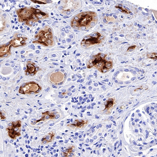KIM-1 Recombinant Rabbit mAb (S-932-2)