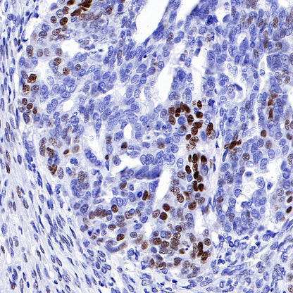 Progesterone Receptor Recombinant Rabbit mAb (SDT-R123)