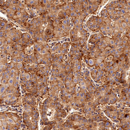 PSEN1 Recombinant Rabbit mAb (S-1002-129)