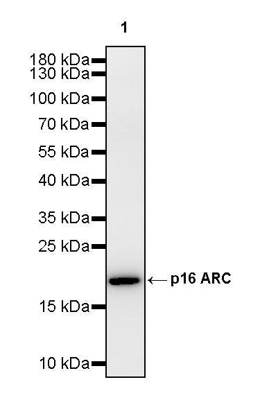 ARPC5/p16 ARC Recombinant Rabbit mAb (S-3564-23)