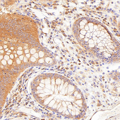EIF2S2 Rabbit Polyclonal Antibody