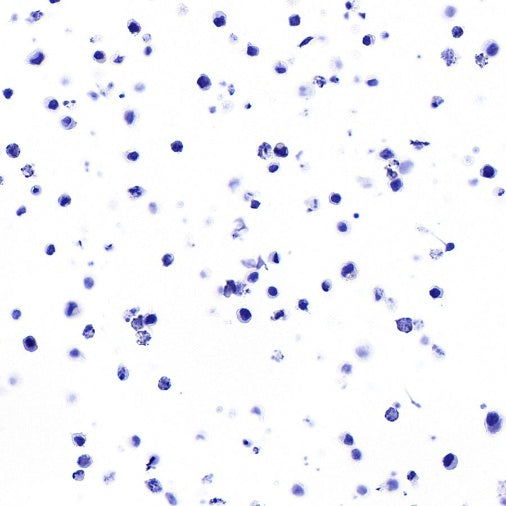 STEAP3 Recombinant Rabbit mAb (S-4466-26)