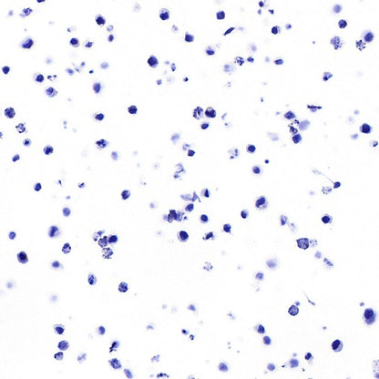STEAP3 Recombinant Rabbit mAb (S-4466-26)