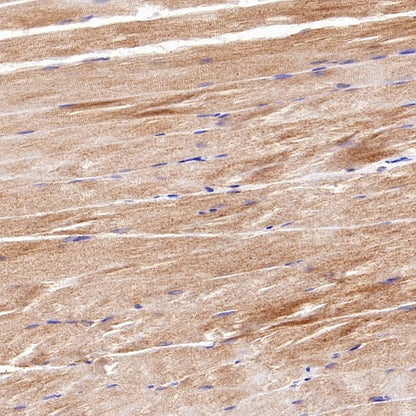 ART1 Recombinant Rabbit mAb (S-2396-1)