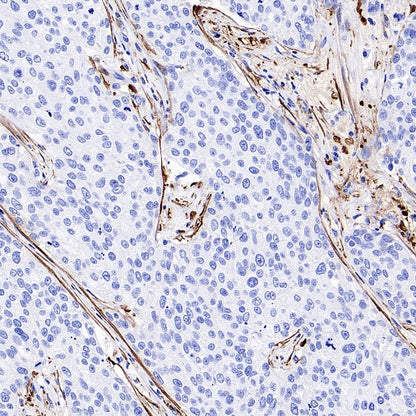 TAGLN/Transgelin Recombinant Rabbit mAb (S-1715-59)