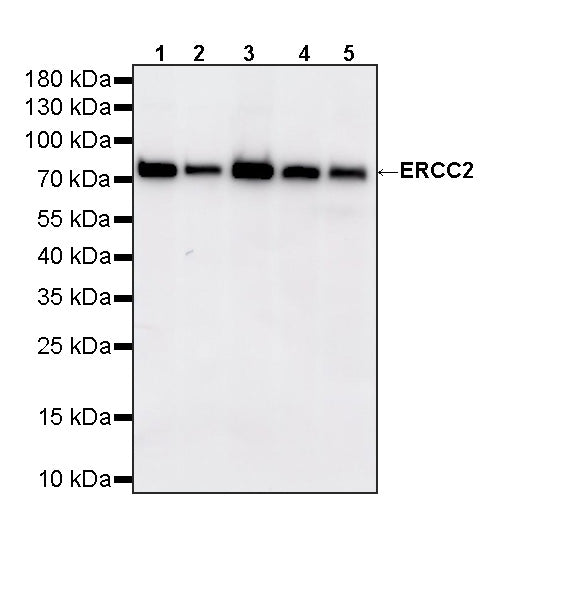ERCC2 Recombinant Rabbit mAb (S-4403-3)