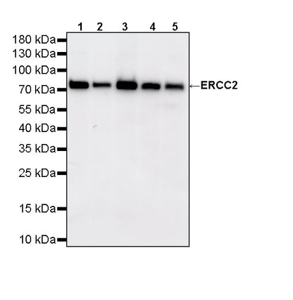 ERCC2 Recombinant Rabbit mAb (S-4403-3)