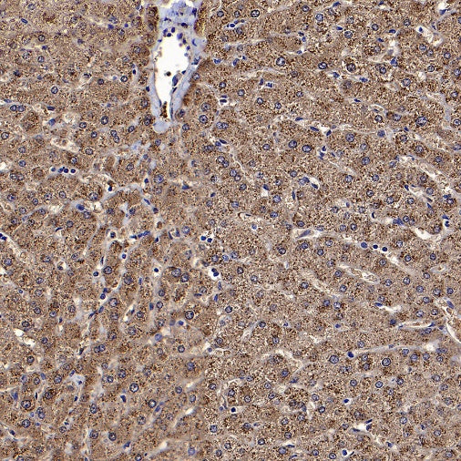 Catalase Recombinant Rabbit mAb (S-1925-3)
