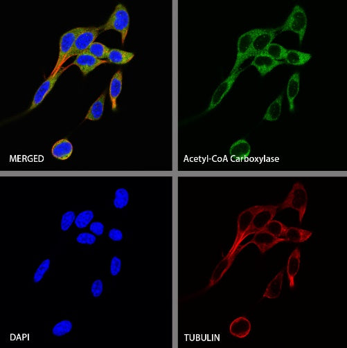 Acetyl-CoA Carboxylase Recombinant Rabbit mAb (S-2220-96)