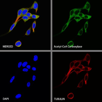 Acetyl-CoA Carboxylase Recombinant Rabbit mAb (S-2220-96)
