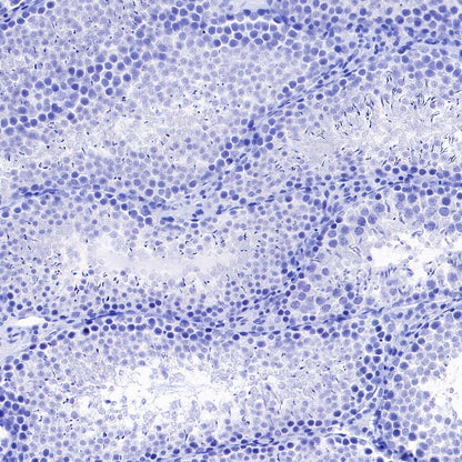 pan SCN Recombinant Rabbit mAb (S-5038)