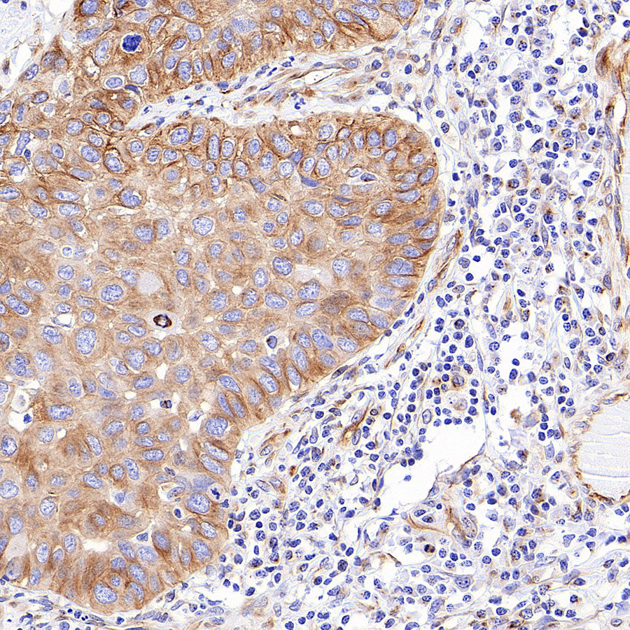 Alpha Tubulin Recombinant Mouse mAb (S-5704)