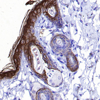 Cytokeratin 1 Recombinant Rabbit mAb (SDT-3225-22)