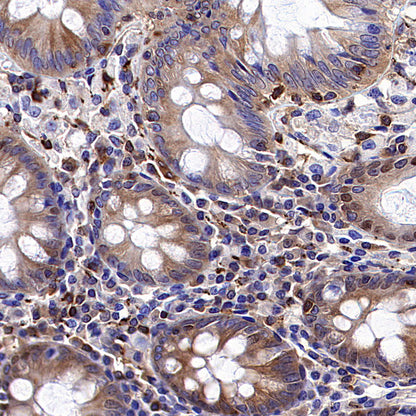 NF-kB p65 Recombinant Rabbit mAb (S-5142)
