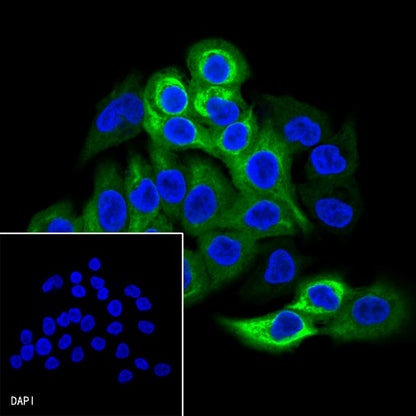 Calpastatin Recombinant Rabbit mAb (S-R184)