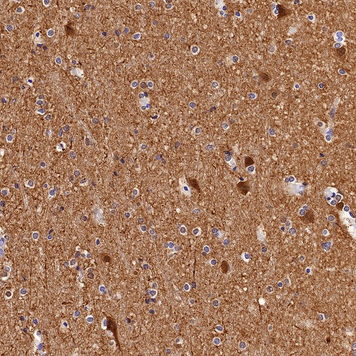 UCHL1 Recombinant Rabbit mAb (S-1765-38)