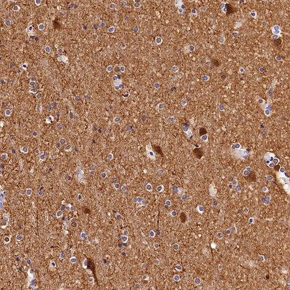 UCHL1 Recombinant Rabbit mAb (S-1765-38)