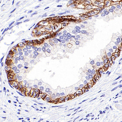 CD44v6 Mouse mAb (S-945-76)